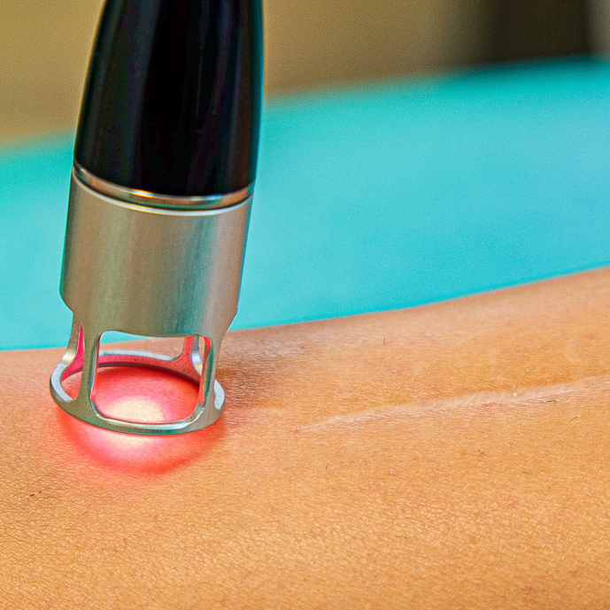 Laserová terapie - HIL • 2 Laserová terapie (HIL)